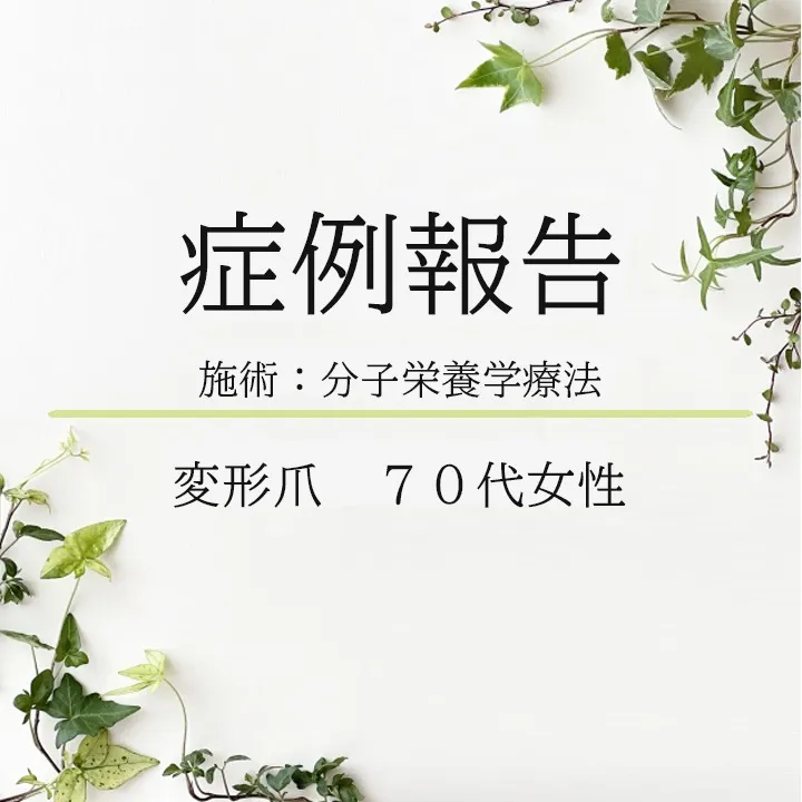 【 症例報告 】変形爪・70代女性
